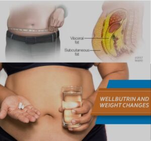 Wellbutrin XL Dosage for Weight Loss